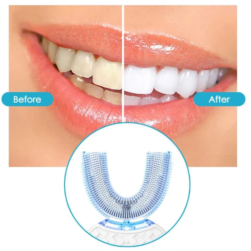 Intelligent Automatic U-Type Sonic Electric Toothbrush – USB Rechargeable with Blue Light Whitening